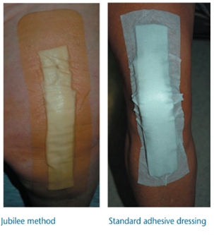 A comparison of a person's leg with a band aid